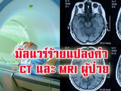 อันตราย! มัลแวร์ตัวใหม่สามารถเปลี่ยนแปลงค่าสแกน CT และ MRI ได้