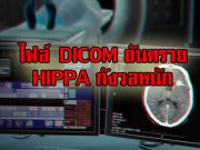 HIPAA กำลังกังวลกับปัญหาอิมเมจไฟล์ DICOM ทางการแพทย์ที่เป็นอันตราย